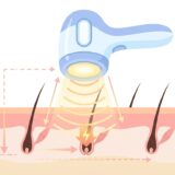 IPL脱毛器の仕組みを現役開発者が解説!選ぶときはワット数より「照射面積×冷却」