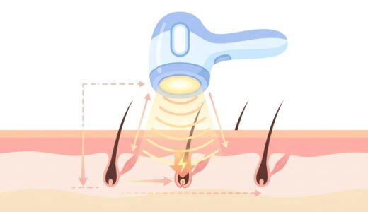 IPL脱毛器の仕組みを現役開発者が解説!選ぶときはワット数より「照射面積×冷却」